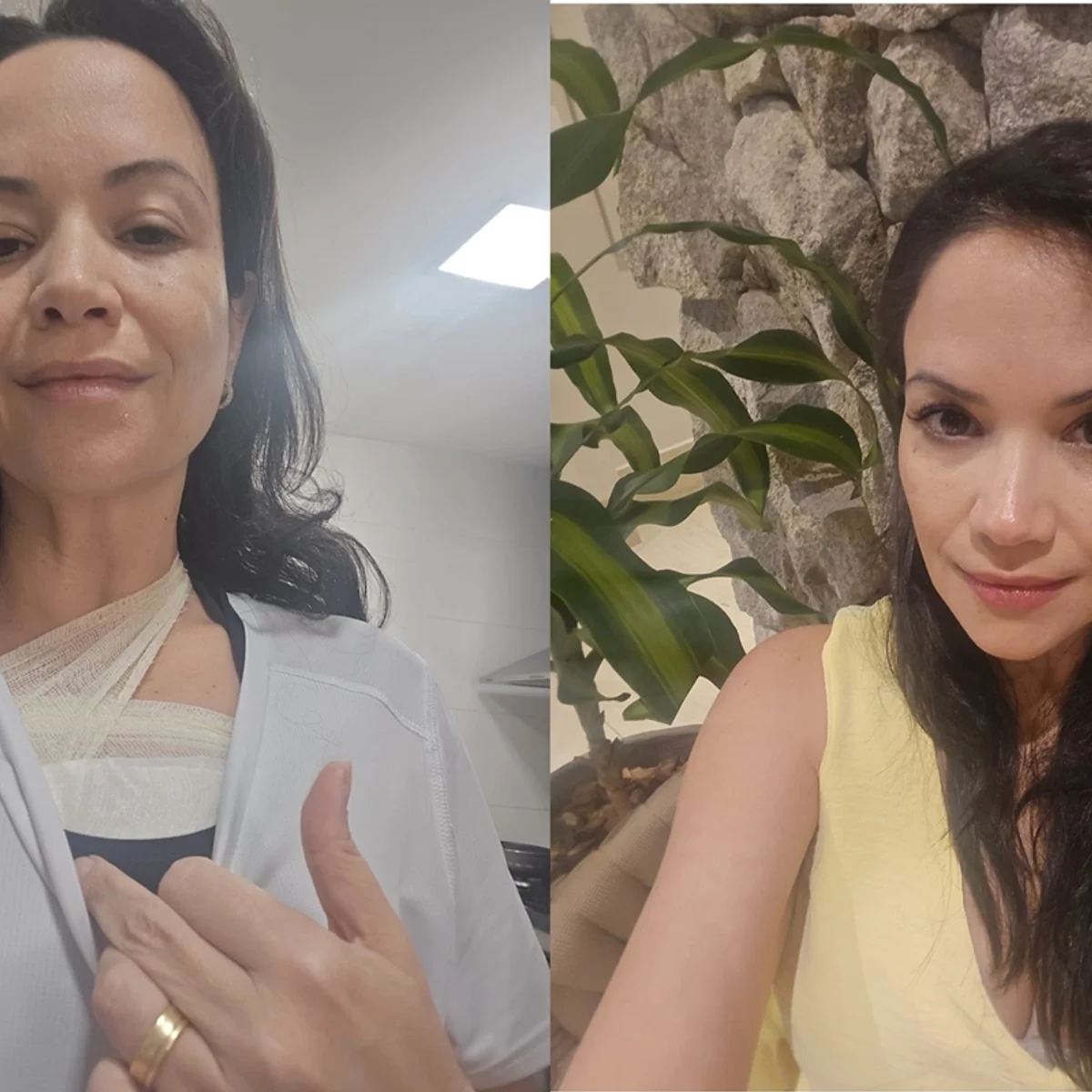 "Preciso viver o agora", diz psiquiatra que descobriu câncer de mama aos 45