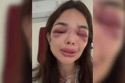 Giullia Kos acusa o marido, Ivo Kos, de agredi-la