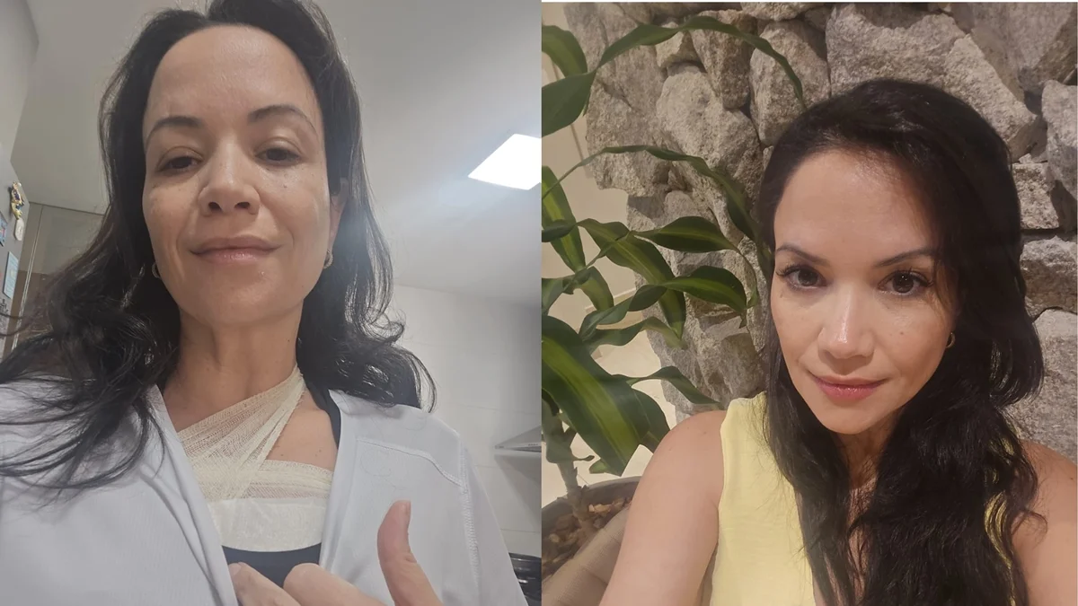 "Preciso viver o agora", diz psiquiatra que descobriu câncer de mama aos 45