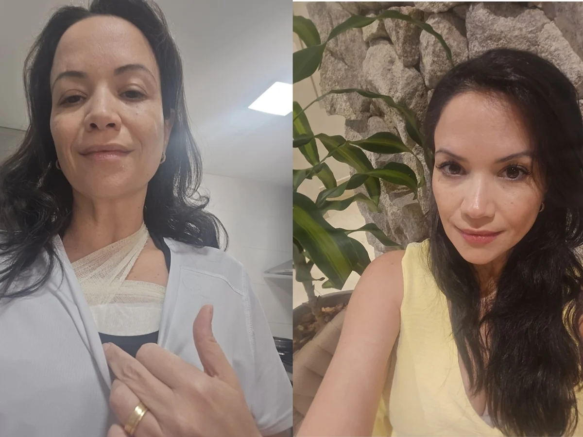 "Preciso viver o agora", diz psiquiatra que descobriu câncer de mama aos 45