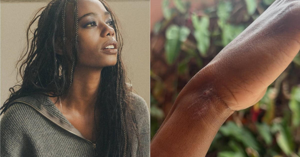 Modelo que sumiu em bairro nobre de SP mostra machucados no corpo em novo desabafo